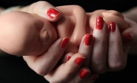 Azərbaycanda abortların sayı niyə yüksəlir?