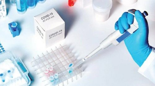 İnnovasiya və Təchizat Mərkəzi 11 milyonluq test alır