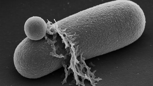 Antibiotiklərin bakteriyaları öldürməsi real vaxt rejimində görüntüləndi