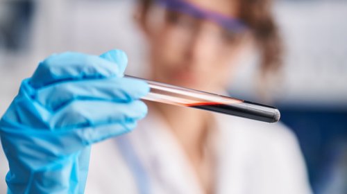 Qanda oksigen çatışmazlığı immun sistemini zəiflədir