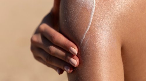 Günəş yanığından qorunmaq dəri xərçənginin qarşısını ala bilər