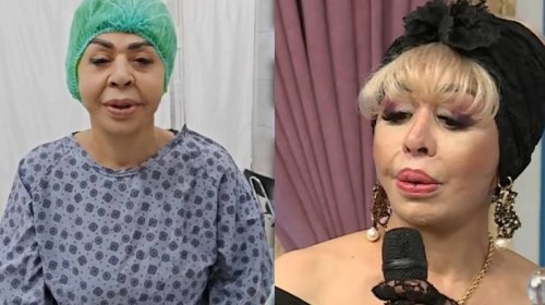 Ruhəngiz Allahverdiyeva plastik əməliyyatdan sonra - FOTO