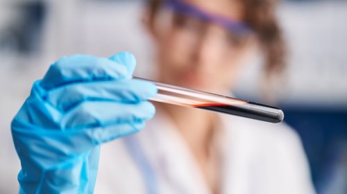 Qan hüceyrələrini "cavanlaşdırmaq" üçün dərman hazırlandı