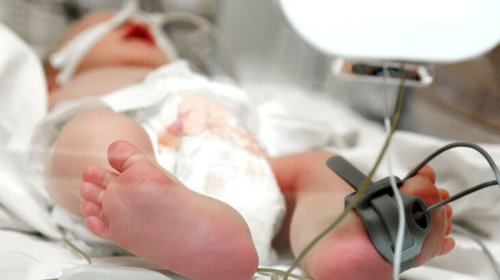 Yenidoğulan uşaqların ölümünün səbəbi nədir?