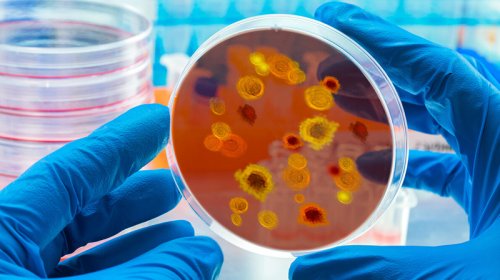 Müalicəyə davamlı göbələk Avropada sürətlə yayılır