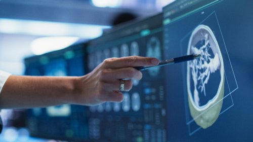 Kimyaterapiyanın təsirini artırmağın gözlənilməz yolu tapıldı