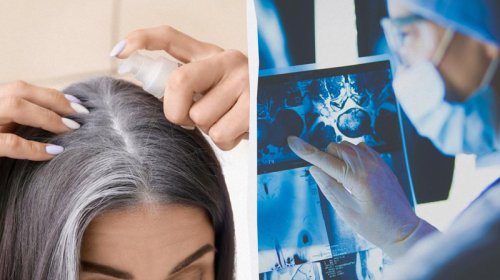 Ağ saçlara görə narahat olmayın: Saçın qocalmasının gözlənilməz funksiyası...