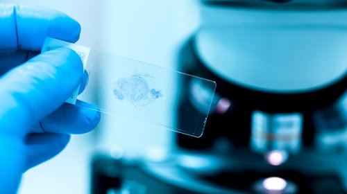 Qastroenteroloq: Üç pəhriz nümunəsi xərçəng riskini azaldır