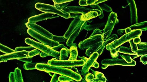 Niyə immunitet vərəm ilə mübarizə apara bilmir? - Alimlər açıqladı