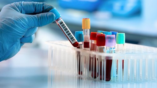 Həkim hər il edilməli olan testləri açıqladı