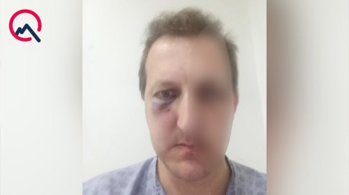 Bakıda Xalq artistinin oğlunu döydülər - Saxlanılan var
