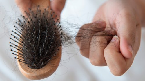 Həkim: "Mövsümi saç tökülməsi 2-3 aydan çox çəkmir"