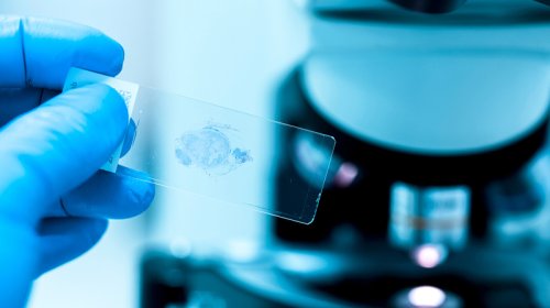 B2 vitamini xərçəng hüceyrələrinin ölümünə qarşı qoruyucu ola bilər - Alimlər