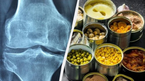 Həkim 50 yaşdan sonra sümükləri möhkəm saxlamağa kömək edən ən yaxşı qidanı açıqladı