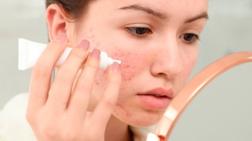 Dermatoloq sağlam dəri üçün lazım olan məhsulları açıqladı