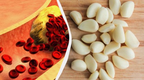 Daha çox sarımsaq yesəniz, xolesterinlə nə baş verə bilər?