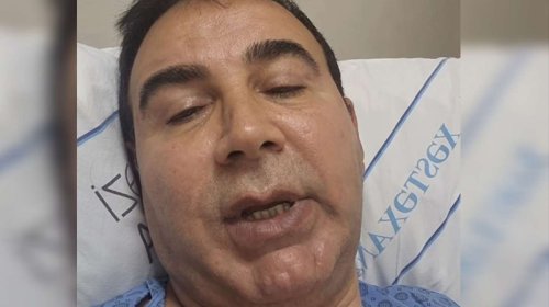 İlham Mirzəyev infarkt keçirib