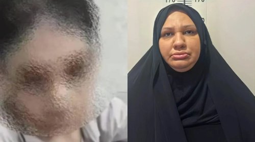 
Azyaşlıya işgəncə verən falçının məhkəməsi: "Hər dəfə uşaq deyirdi ki, pişik cırmaqlayıb"

