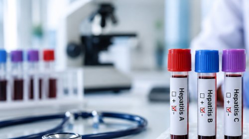 Azərbaycanda hepatitə yoluxma kəskin azalıb - RƏQƏMLƏR