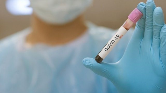 Son sutkada Azərbaycanda neçə nəfər koronavirusa yoluxub? (RƏSMİ) 
