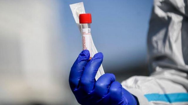 Azərbaycanda daha üç nəfər koronavirusdan öldü: 143 yeni yoluxma - RƏSMİ