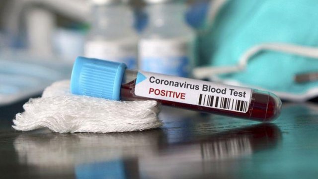 Naxçıvanda neçə koronavirusa yoluxma qeydə alınıb?