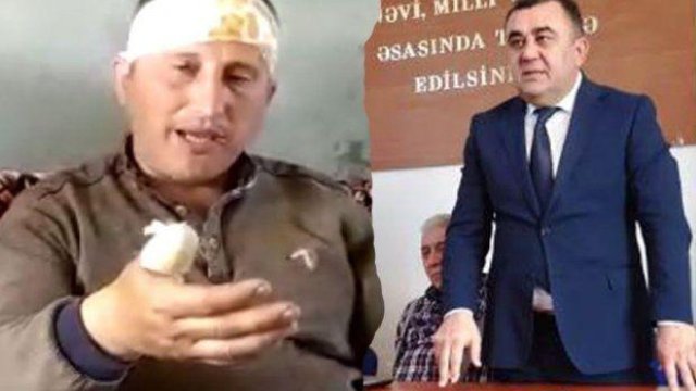 İcra Hakimiyyətindən vətəndaşın döyülmə xəbəri ilə bağlı AÇIQLAMA