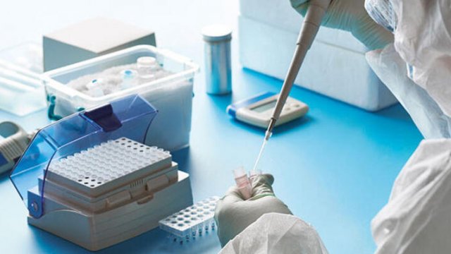 Azərbaycanda koronavirusdan 4 nəfər də öldü - Yoluxma faktı yüksəkdir