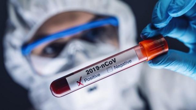 Hansı azərbaycanlı məşhurlar koronavirusa yoluxub?