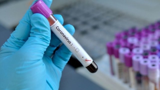 Azərbaycanda koronavirusdan 4 nəfər də öldü - BU GÜNÜN STATİSTİKASI