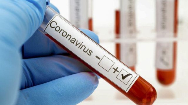 Operativ Qərargah koronavirusa yoluxmada artımın səbəbini AÇIQLADI