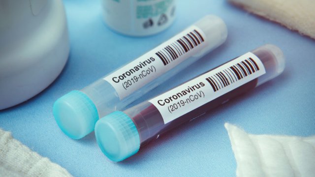 Daha bir məktəb direktoru koronavirusa yoluxdu