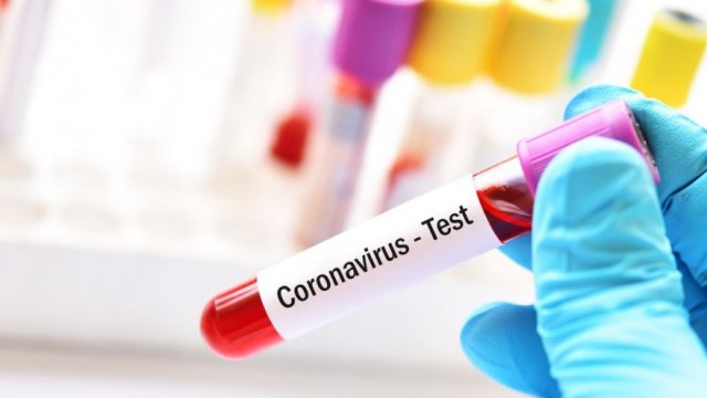 Bunlar da koronavirus əlamətidir?