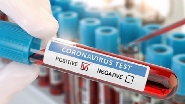 Klinikalar koronavirus testi müayinələrini dayandırdı