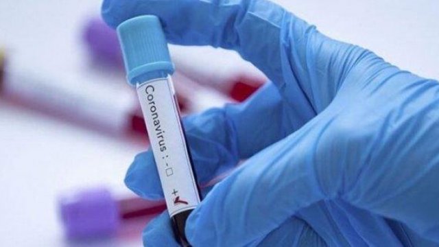 Harvard doktoru koronavirusla bağlı tarix verdi