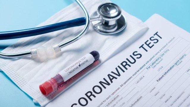 Hər yerdə havayı, Azərbaycanda pulla... – Koronavirus testləriylə bağlı açıqlama