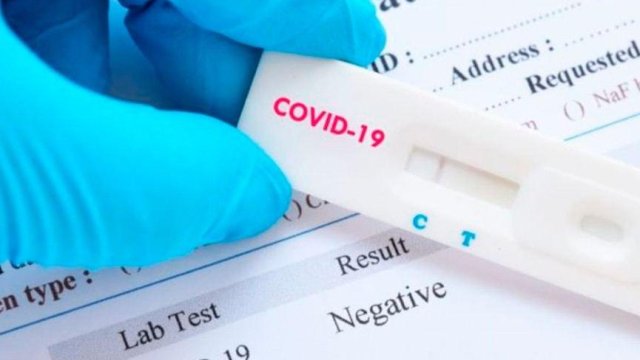 Testin nəticəsinin mənfi olması o demək deyil ki, həmin adam koronavirusa yoluxmayıb - Nazirlik