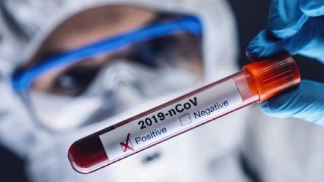 Azərbaycanda koronavirusa yoluxanların sayı artdı - BU GÜNÜN STATİSTİKASI
