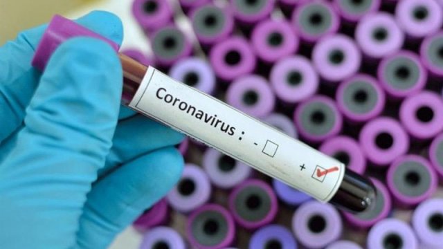 Koronavirus testlərinin qiyməti niyə yüksəkdir? – Deputat açıqladı