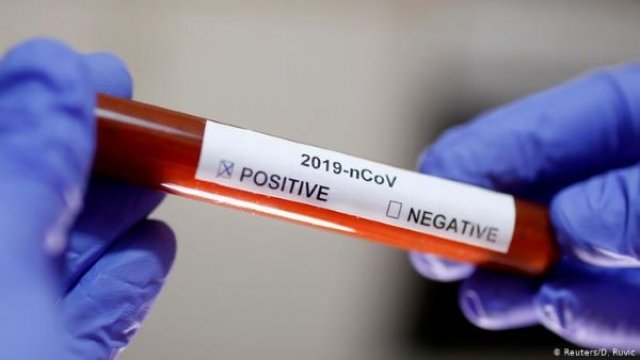 Koronavirus testiylə bağlı daha bir yanlışlıq, körpə uşağa... -  FOTO