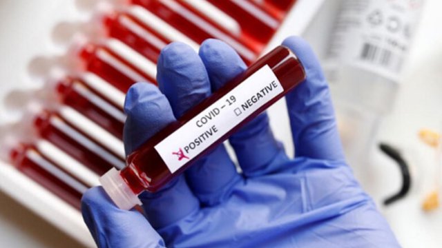 Azərbaycanda koronavirusdan 2 nəfər də öldü - BU GÜNÜN STATİSTİKASI