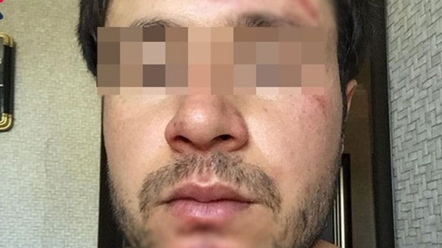 “Pul vermədim deyə baş həkim məni yumruqladı” - FOTO