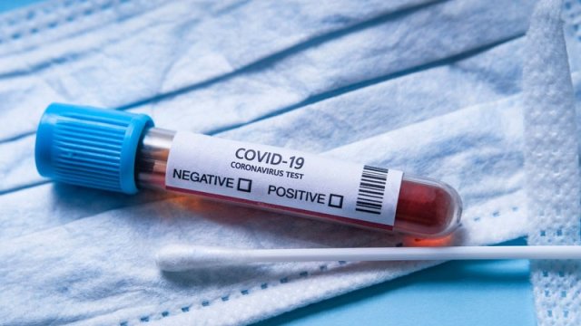 Koronavirusa yoluxanların sayı açıqlandı - GÜNÜN STATİSTİKASI