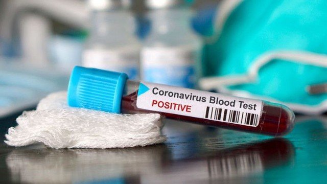 xa0Azərbaycandaxa0 koronavirusdan ölənlərin sayı 545-ə çatdı