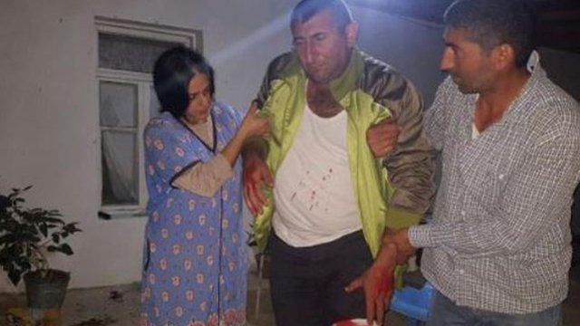 Ermənilərin yaraladığı mülki vətəndaşımızın  FOTOSU