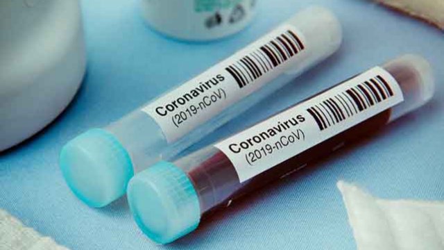 Azərbaycanda koronavorusa yoluxanların sayı yenə azdır - GÜNÜN STATİSTİKASI