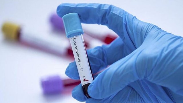 Azərbaycanda koronavirusa yoluxanların sayı azaldı - GÜNÜN STATİSTİKASI