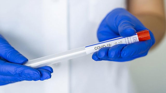 Koronavirusa yoluxanların sayı artdı - Günün statistikası