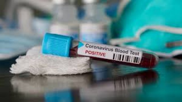 Koronavirusa yoluxanların sayı açıqlandı, 2 nəfər vəfat etdi - GÜNÜN STATİSTİKASI