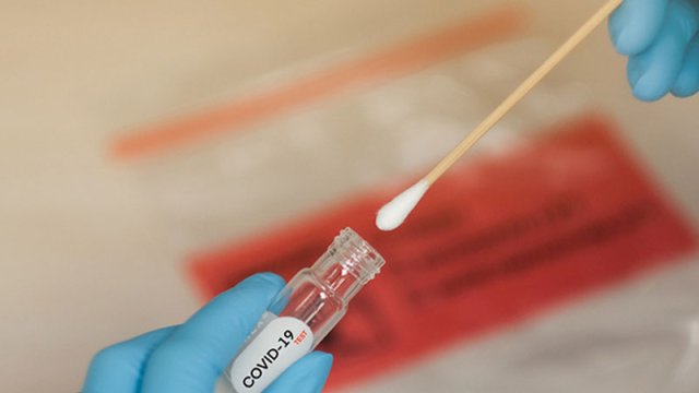 Yoluxanların sayı 800-ü keçdi, 6 nəfər vəfat etdi - GÜNÜN STATİSTİKASI